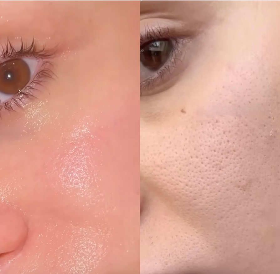VITALFACE™ - Ton Nouvel Allié Beauté